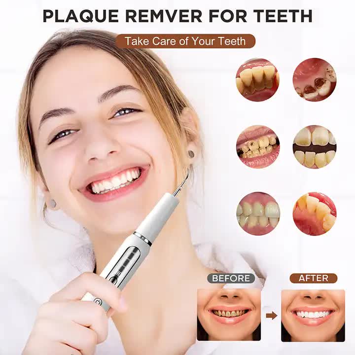 Ultrasonic Dental Cleaner Kit – Electric Plaque & Tartar Remover, Rechargeable Teeth Scaler