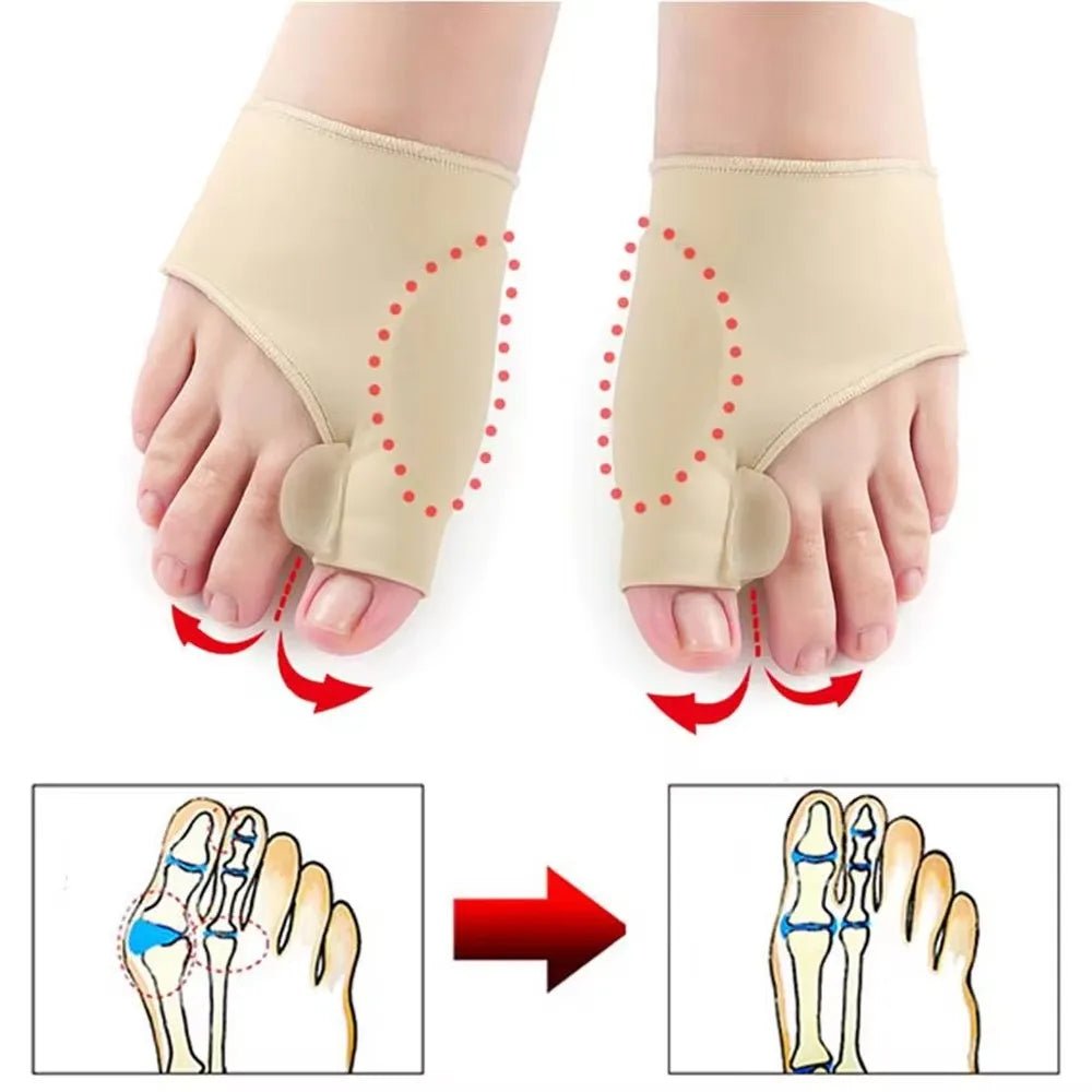 Orthotic Bunion Corrector Toe Straightener Pair
