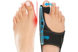 Adjustable Orthopaedic Bunion Corrector