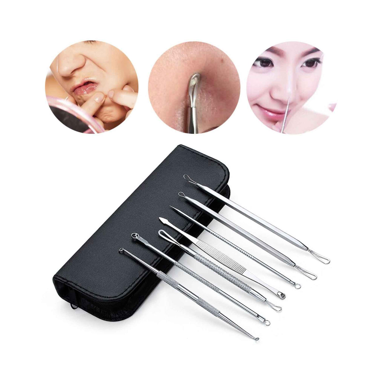 Blackhead Remover Kit
