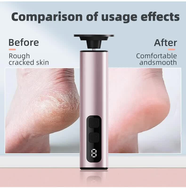 Rechargeable Electric Foot File