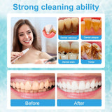 Ultrasonic Dental Scaler Kit - Teeth Cleaner & Tartar Remover